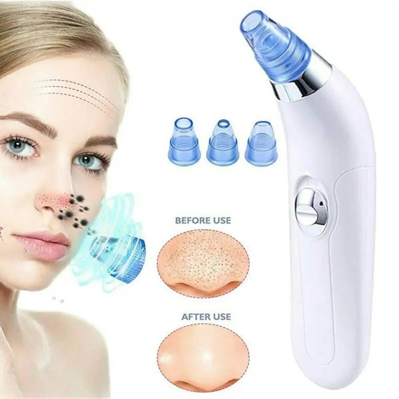 Derma Suction Blackheads Remover Device